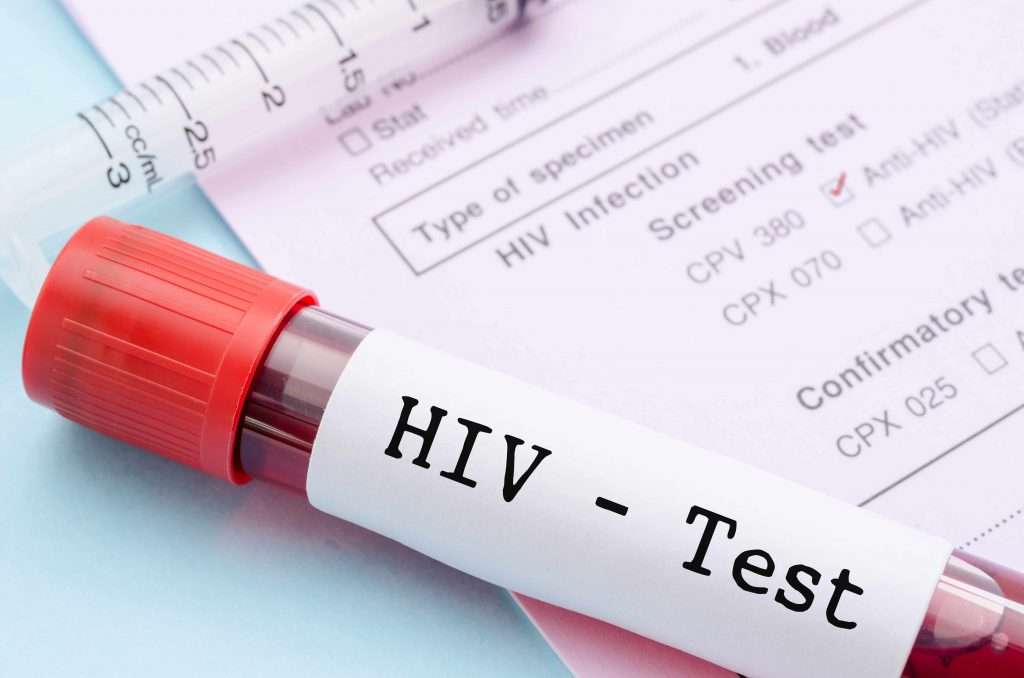 Un nuevo dispositivo diagnostica el VIH en minutos y no días